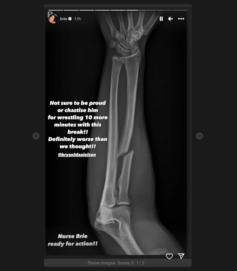 Bryan Danielson's Arm Injury Worse Than Initially Thought, Brie Garcia Posts Photo Of X-Ray